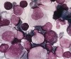 mononucleose