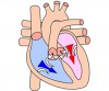 Coração em desenho mostrando seu funcionamento durante diástole.
