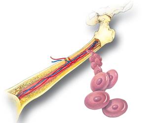 Leucemia no sangue